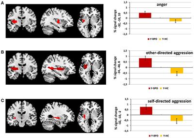 Heightened Salience of Anger and Aggression in Female Adolescents With Borderline Personality Disorder—A Script-Based fMRI Study